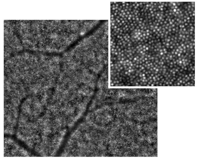 image of eye using rtx1 adaptive optics for ophthalmology